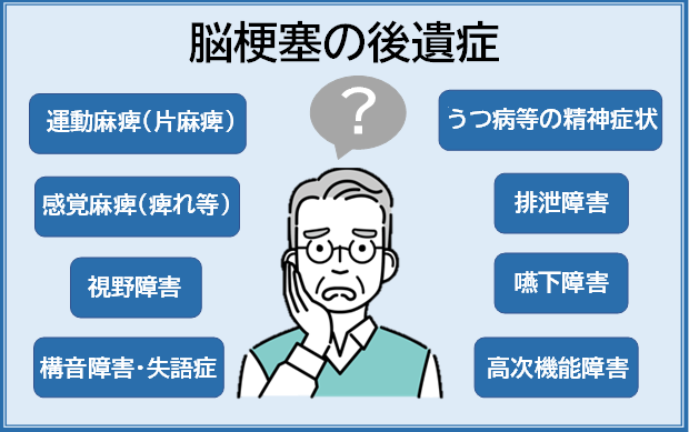 脳梗塞の後遺症とは？症状や原因、リハビリについて解説