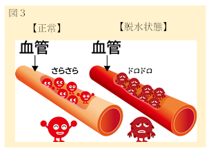 血栓が形成されやすい状態