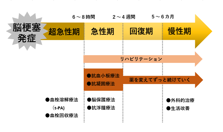 脳梗塞発症から脳梗塞の治療と治療後のリハビリ