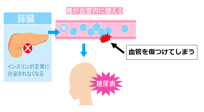 糖尿病