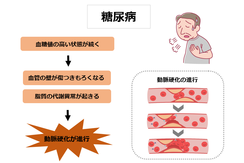 脳梗塞の危険因子_糖尿病