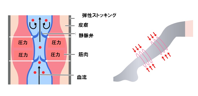 装具療法