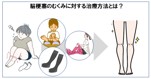 脳梗塞のむくみに対する治療方法とは