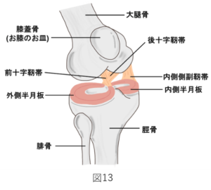 二次性の変形性膝関節症の原因