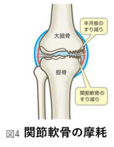 関節軟骨の摩擦