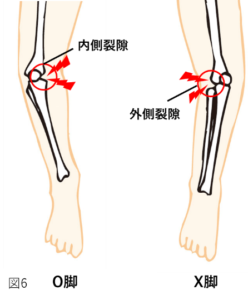 膝関節周囲の痛み