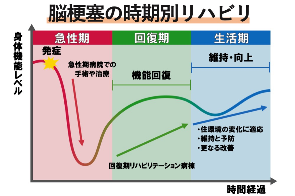 脳梗塞の時期別リハビリ