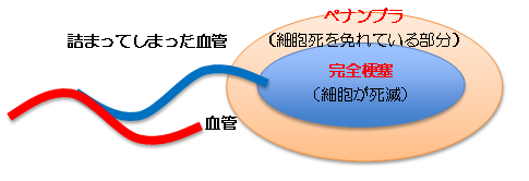 ペナンプラ