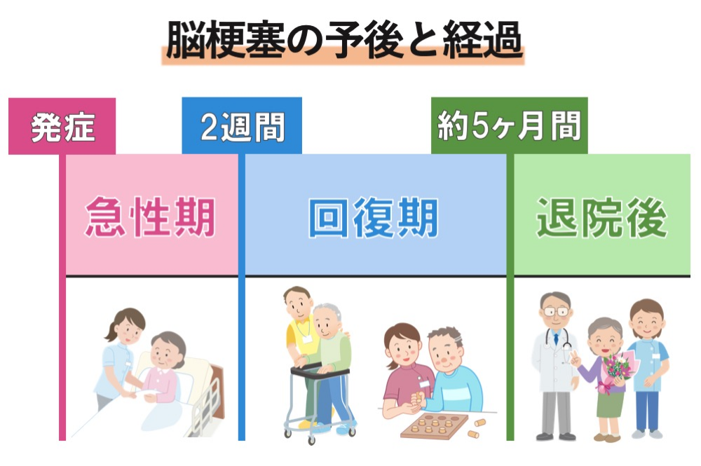 脳梗塞の予後と経過