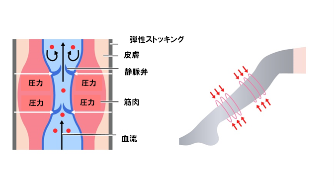 むくみの軽減のメカニズム