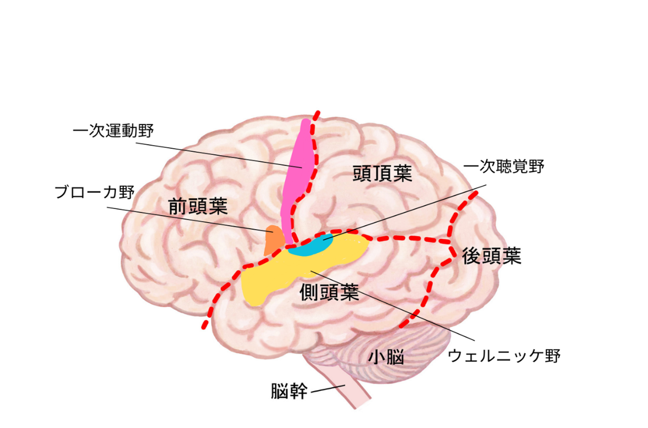 感覚性失語（ウェルニッケ失語）