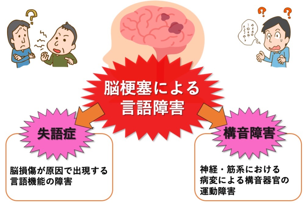 脳梗塞による言語障害（失語症・構音障害）とは