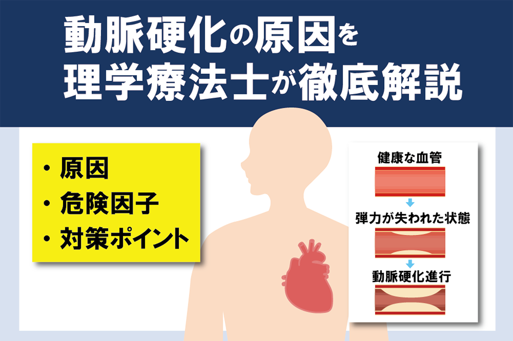 動脈硬化の原因を理学療法士が徹底解説