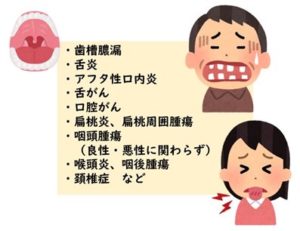 嚥下障害とは？原因と症状を分かりやすく解説｜＜公 …